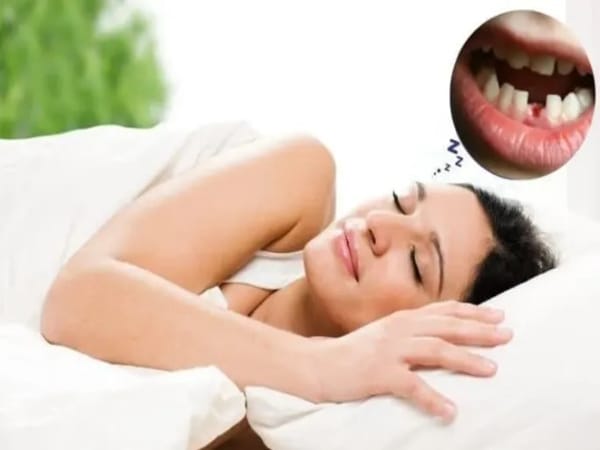 Nằm mộng thấy rụng răng chọn con gì, số mấy hưởng tài lộc